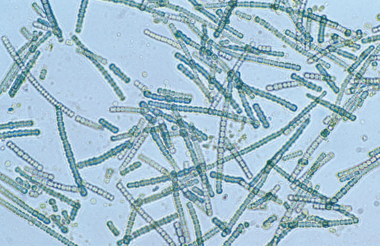 Cylindrospermum sp. siyanobakterisinin mikroskop görüntüsü, hücre zincirleri belirgin biçimde görülüyor