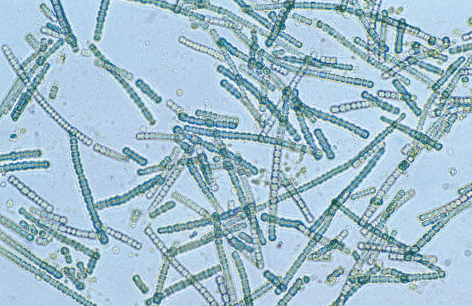 Cylindrospermum sp. siyanobakterisinin mikroskop görüntüsü, hücre zincirleri belirgin biçimde görülüyor