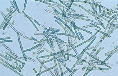 Microscopic image of Cylindrospermum sp. cyanobacteria, with cell chains clearly visible