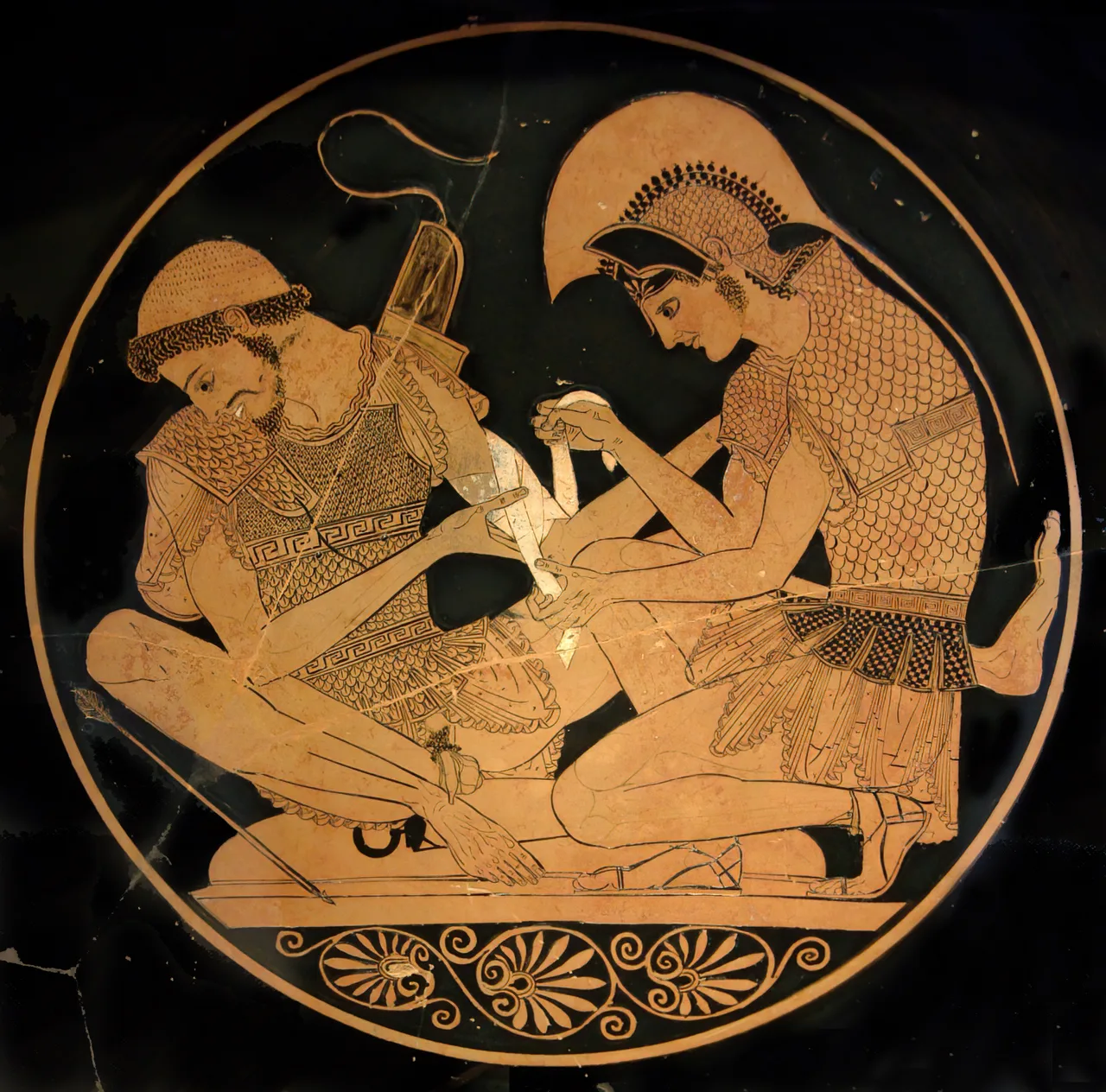 An Athenian red-figure cup tondo, ca. 500 BCE, showing Achilles bandaging the wounded Patroclus