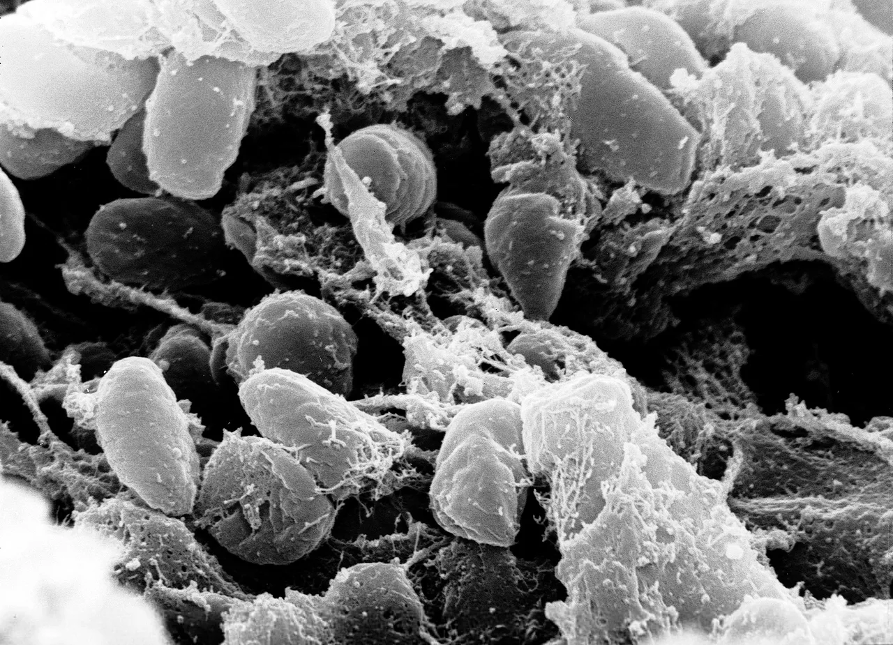 A scanning electron microscope image of a mass of Yersinia pestis bacteria collected in the digestive system of a flea, shown in orange against a dark background