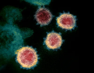 Colorized electron-microscope image: a cluster of round yellow virus particles emerging from a cell surface